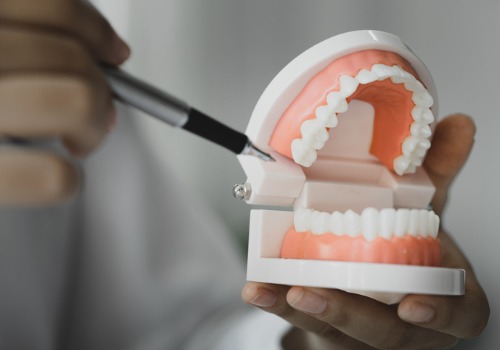 A tooth model is used for teaching. River City Family Dentistry is one of the top Dentist Offices in Peoria IL.